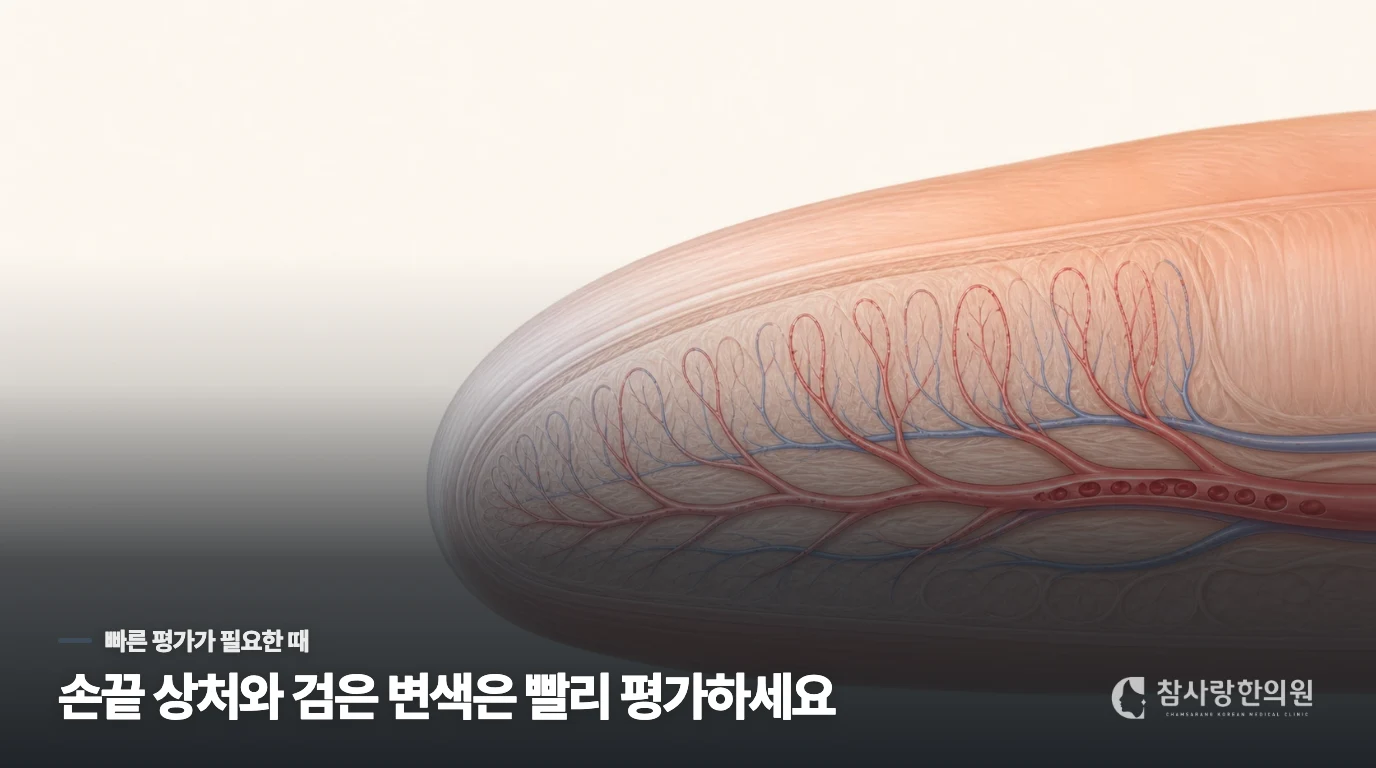 손끝 상처와 검은 변색은 빠른 평가가 필요합니다