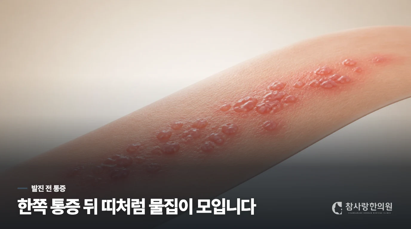 한쪽 피부가 먼저 화끈거리고 며칠 뒤 물집이 모입니다