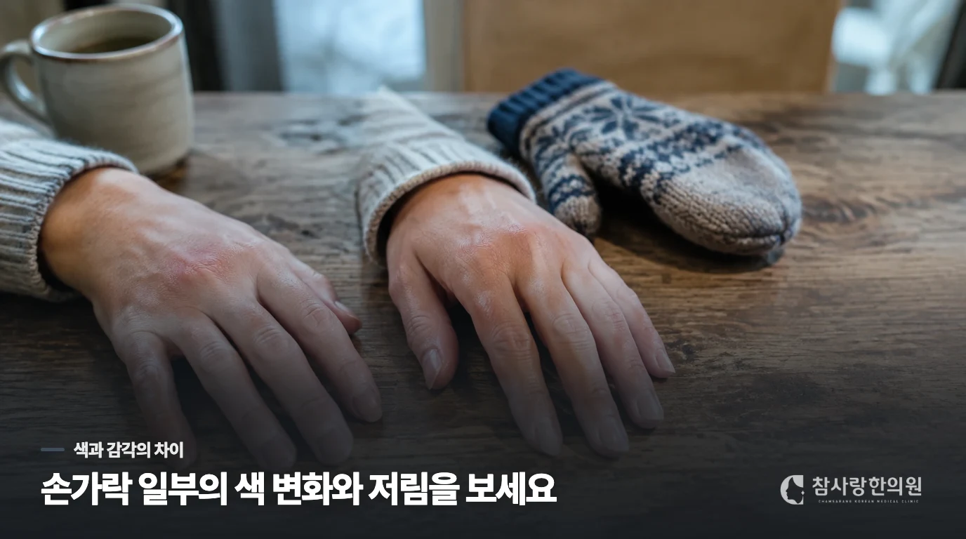 손발 전체가 시린 것과 손가락 일부가 변하는 것은 다릅니다