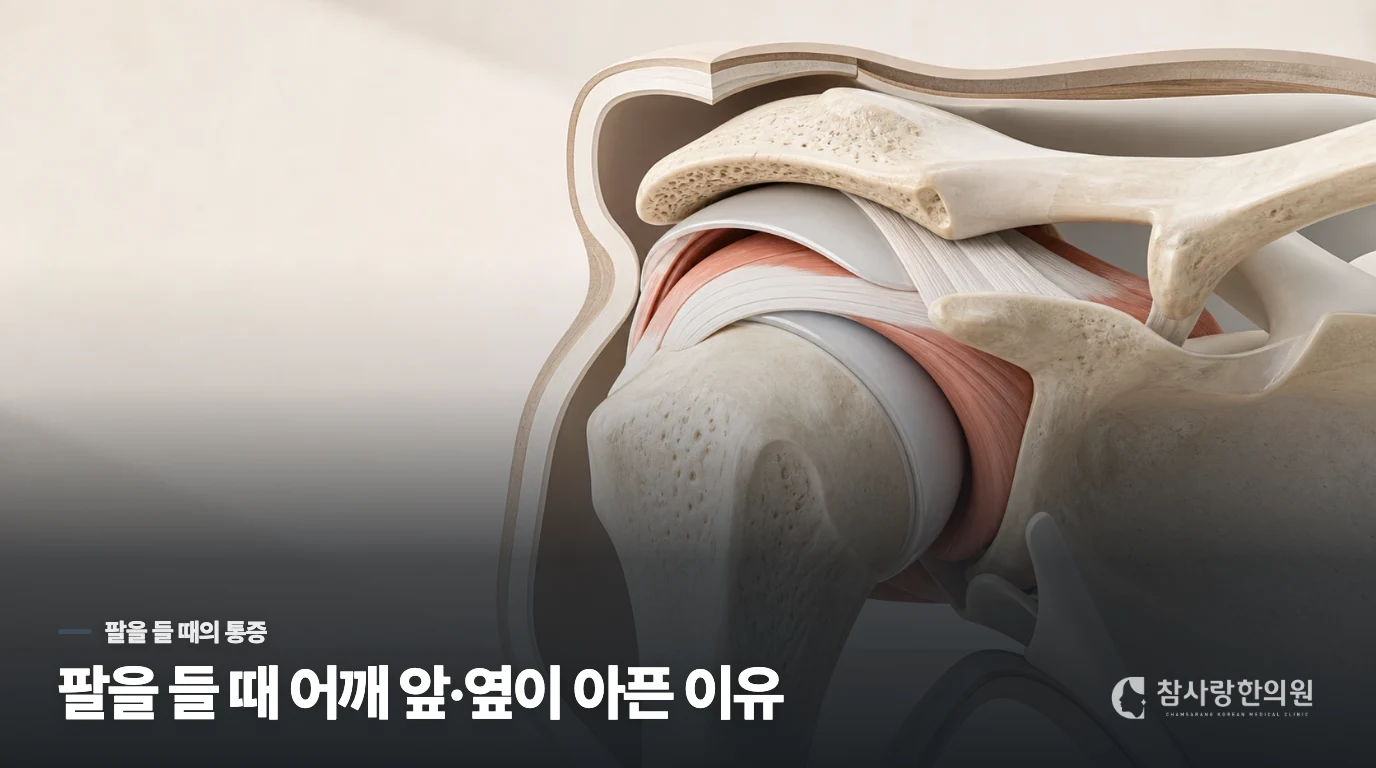 팔을 올릴 때 어깨 앞쪽이 아픈 이유는 무엇인가요?