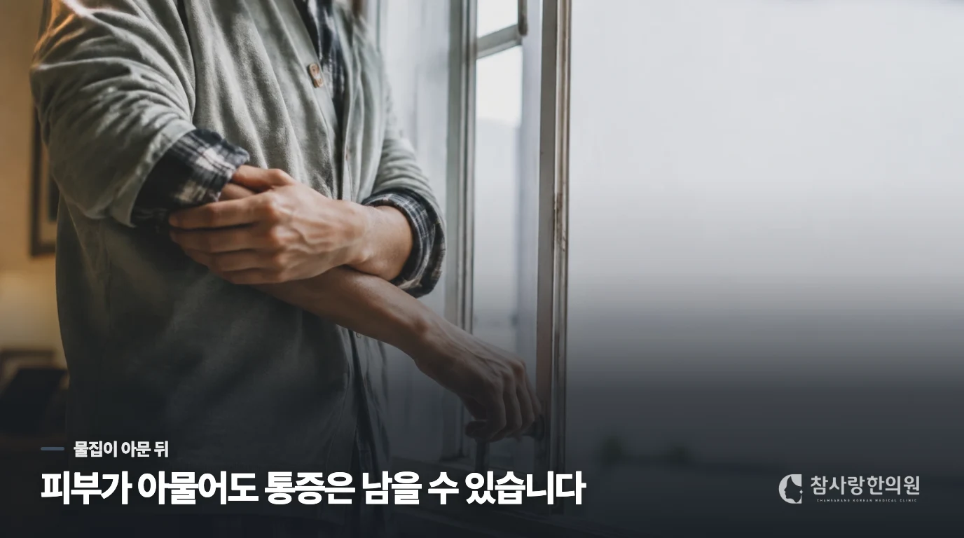 물집은 나았는데 잠자리에 들기가 두려워질 때