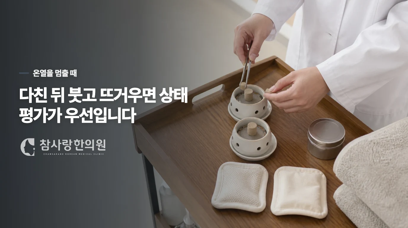 열감이나 외상이 있으면 온찜질의 기준이 달라집니다