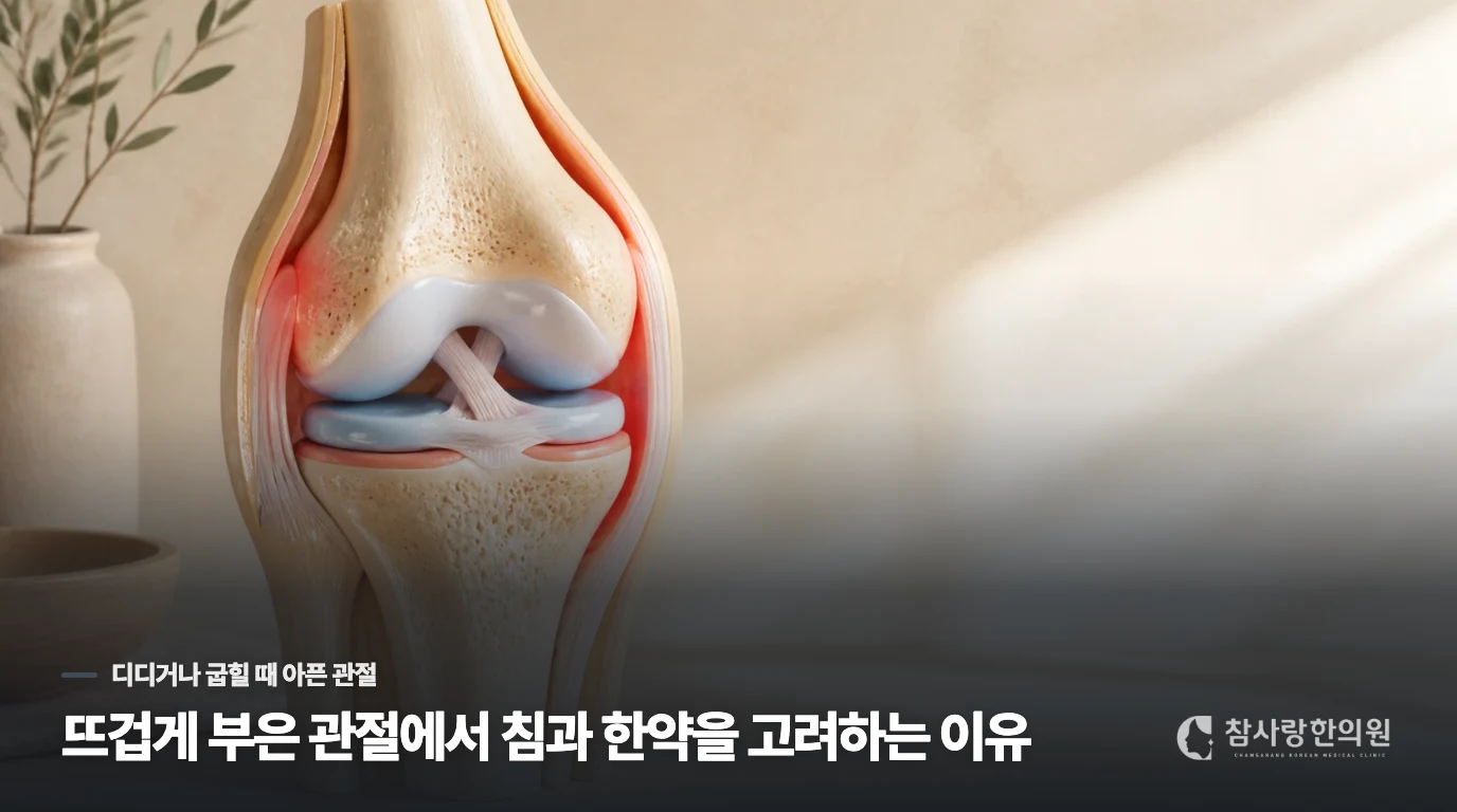뜨겁게 부은 관절에서 침과 한약을 고려하는 이유