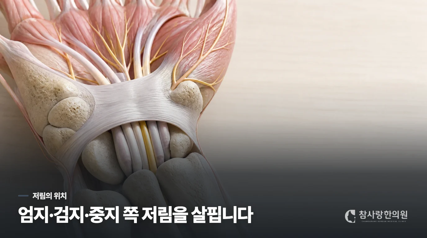 저린 손가락의 위치가 손목터널증후군을 떠올리게 하는 이유